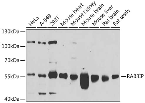 Western Blot: RAB3IP Antibody [NBP3-38505] - Western blot analysis of various lysates using RAB3IP Rabbit pAb at 1:1000 dilution.Secondary antibody: HRP-conjugated Goat anti-Rabbit IgG (H+L) at 1:10000 dilution.Lysates/proteins: 25ug per lane.Blocking buffer: 3% nonfat dry milk in TBST.Detection: ECL Basic Kit.Exposure time: 30s.