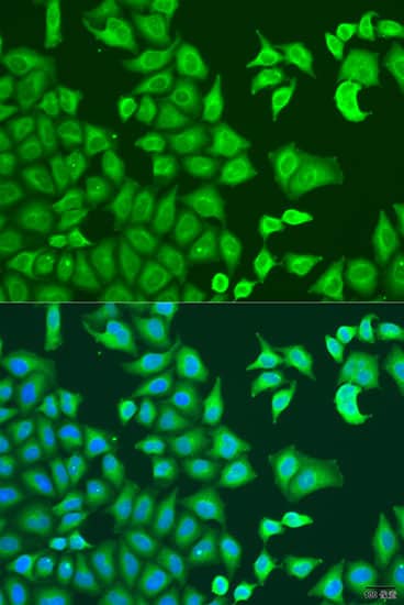 Immunocytochemistry/ Immunofluorescence: CAPZB Antibody [NBP3-38507] - Immunofluorescence analysis of U2OS cells using CAPZB Rabbit pAb at dilution of 1:100. Secondary antibody: Cy3-conjugated Goat anti-Rabbit IgG (H+L) at 1:500 dilution. Blue: DAPI for nuclear staining.