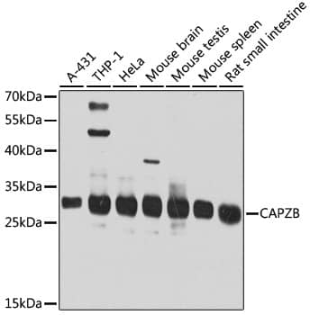 Western Blot: CAPZB Antibody [NBP3-38507] - Western blot analysis of various lysates using CAPZB Rabbit pAb at 1:1000 dilution.Secondary antibody: HRP-conjugated Goat anti-Rabbit IgG (H+L) at 1:10000 dilution.Lysates/proteins: 25ug per lane.Blocking buffer: 3% nonfat dry milk in TBST.Detection: ECL Basic Kit.Exposure time: 30s.