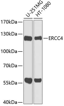 Western Blot: XPF Antibody [NBP3-38510] - Western blot analysis of various lysates using XPF Rabbit pAb at 1:1000 dilution.Secondary antibody: HRP-conjugated Goat anti-Rabbit IgG (H+L) at 1:10000 dilution.Lysates/proteins: 25ug per lane.Blocking buffer: 3% nonfat dry milk in TBST.Detection: ECL Basic Kit.Exposure time: 30s.