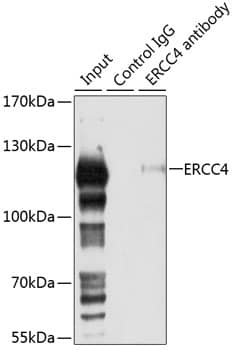 Immunoprecipitation: XPF Antibody [NBP3-38510] - Immunoprecipitation analysis of 150 ug extracts of 293T cells using 3 ug XPF antibody. Western blot was performed from the immunoprecipitate using XPF antibody at a dilution of 1:1000.