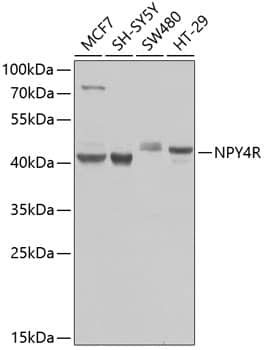 Western Blot NPY4R Antibody