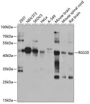 Western Blot: RGS20 Antibody [NBP3-38513] - Western blot analysis of various lysates using RGS20 Rabbit pAb at 1:1000 dilution.Secondary antibody: HRP-conjugated Goat anti-Rabbit IgG (H+L) at 1:10000 dilution.Lysates/proteins: 25ug per lane.Blocking buffer: 3% nonfat dry milk in TBST.Detection: ECL Basic Kit.Exposure time: 15s.