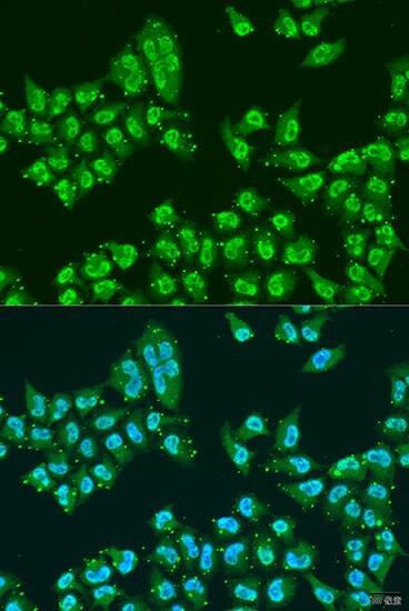 Immunocytochemistry/ Immunofluorescence: hHpr1-p84-Thoc1 Antibody [NBP3-38514] - Immunofluorescence analysis of U2OS cells using hHpr1-p84-Thoc1(THOC1) Rabbit pAb at dilution of 1:100. Secondary antibody: Cy3-conjugated Goat anti-Rabbit IgG (H+L) at 1:500 dilution. Blue: DAPI for nuclear staining.