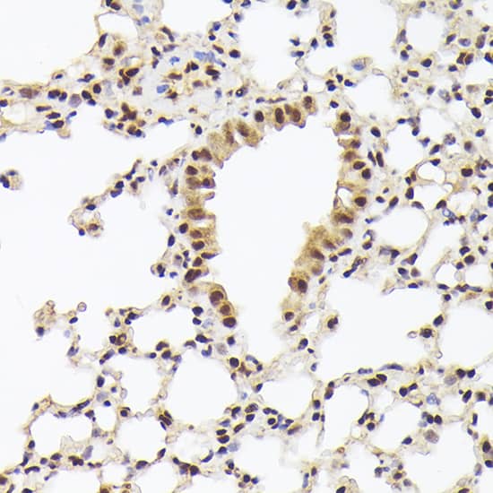 Immunohistochemistry: hHpr1-p84-Thoc1 Antibody [NBP3-38514] - Immunohistochemistry analysis of paraffin-embedded Mouse lung using hHpr1-p84-Thoc1(THOC1) Rabbit pAb at dilution of 1:100 (40x lens). High pressure antigen retrieval performed with 0.01M Citrate Bufferr (pH 6.0) prior to IHC staining.