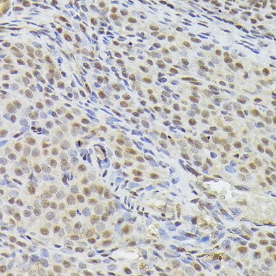 Immunohistochemistry: hHpr1-p84-Thoc1 Antibody [NBP3-38514] - Immunohistochemistry analysis of paraffin-embedded Rat ovary using hHpr1-p84-Thoc1(THOC1) Rabbit pAb at dilution of 1:100 (40x lens). High pressure antigen retrieval performed with 0.01M Citrate Bufferr (pH 6.0) prior to IHC staining.