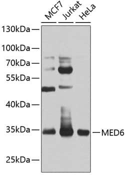 Western Blot: MED6 Antibody [NBP3-38515] - Western blot analysis of various lysates using MED6 Rabbit pAb at 1:1000 dilution.Secondary antibody: HRP-conjugated Goat anti-Rabbit IgG (H+L) at 1:10000 dilution.Lysates/proteins: 25ug per lane.Blocking buffer: 3% nonfat dry milk in TBST.Detection: ECL Basic Kit.Exposure time: 45s.