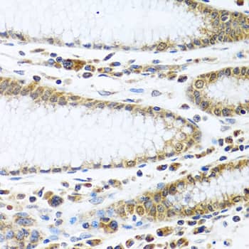 Immunohistochemistry: IFI44 Antibody [NBP3-38516] - Immunohistochemistry analysis of paraffin-embedded Human stomach using IFI44 Rabbit pAb at dilution of 1:100 (40x lens). Microwave antigen retrieval performed with 0.01M PBS Buffer (pH 7.2) prior to IHC staining.
