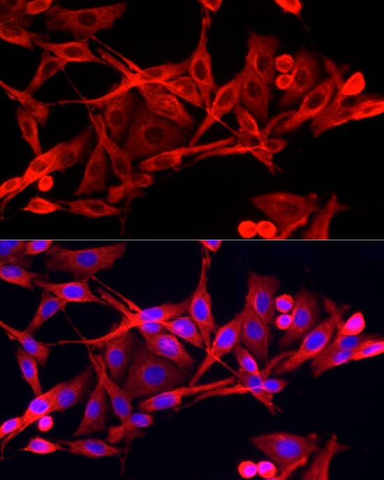Immunocytochemistry/ Immunofluorescence: IFI44 Antibody [NBP3-38516] - Immunofluorescence analysis of PC-12 cells using IFI44 Rabbit pAb at dilution of 1:50 (40x lens). Secondary antibody: Cy3-conjugated Goat anti-Rabbit IgG (H+L) at 1:500 dilution. Blue: DAPI for nuclear staining.