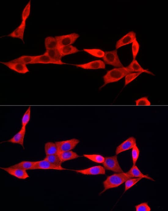 Immunocytochemistry/ Immunofluorescence: IFI44 Antibody [NBP3-38516] - Immunofluorescence analysis of NIH/3T3 cells using IFI44 Rabbit pAb at dilution of 1:50 (40x lens). Secondary antibody: Cy3-conjugated Goat anti-Rabbit IgG (H+L) at 1:500 dilution. Blue: DAPI for nuclear staining.