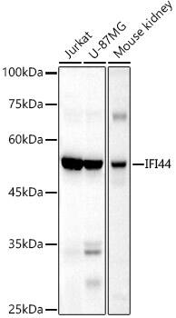 Western Blot: IFI44 Antibody [NBP3-38516] - Western blot analysis of various lysates using IFI44 Rabbit pAb at 1:1000 dilution.Secondary antibody: HRP-conjugated Goat anti-Rabbit IgG (H+L) at 1:10000 dilution.Lysates/proteins: 25ug per lane.Blocking buffer: 3% nonfat dry milk in TBST.Detection: ECL Basic Kit.Exposure time: 30s.