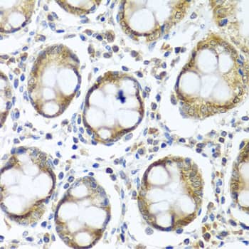Immunohistochemistry IFI44 Antibody - BSA Free