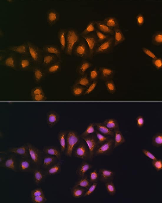 Immunocytochemistry/ Immunofluorescence: STK38 Antibody [NBP3-38517] - Immunofluorescence analysis of U2OS cells using STK38 Rabbit pAb at dilution of 1:100. Secondary antibody: Cy3-conjugated Goat anti-Rabbit IgG (H+L) at 1:500 dilution. Blue: DAPI for nuclear staining.