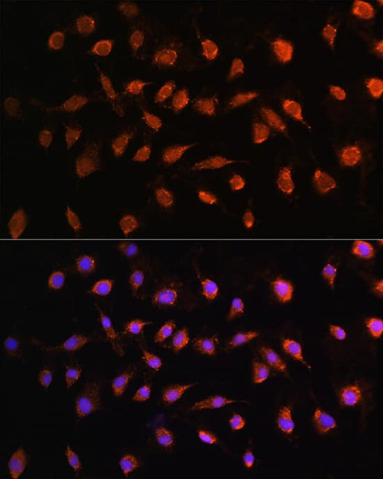 Immunocytochemistry/ Immunofluorescence: STK38 Antibody [NBP3-38517] - Immunofluorescence analysis of L929 cells using STK38 Rabbit pAb at dilution of 1:100. Secondary antibody: Cy3-conjugated Goat anti-Rabbit IgG (H+L) at 1:500 dilution. Blue: DAPI for nuclear staining.