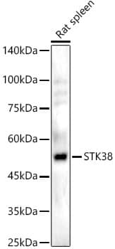 Western Blot: STK38 Antibody [NBP3-38517] - Western blot analysis of various lysates, using STK38 Rabbit pAb at 1:800 dilution.Secondary antibody: HRP-conjugated Goat anti-Rabbit IgG (H+L) at 1:10000 dilution.Lysates/proteins: 25ug per lane.Blocking buffer: 3% nonfat dry milk in TBST.Detection: ECL Basic Kit.Exposure time: 180s.