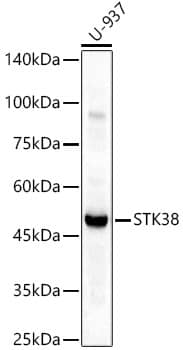 Western Blot: STK38 Antibody [NBP3-38517] - Western blot analysis of various lysates, using STK38 Rabbit pAb at 1:800 dilution.Secondary antibody: HRP-conjugated Goat anti-Rabbit IgG (H+L) at 1:10000 dilution.Lysates/proteins: 25ug per lane.Blocking buffer: 3% nonfat dry milk in TBST.Detection: ECL Basic Kit.Exposure time: 30s.