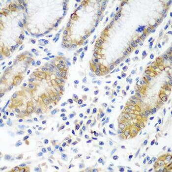 Immunohistochemistry: ATAD3A Antibody [NBP3-38518] - Immunohistochemistry analysis of paraffin-embedded Human stomach using ATAD3A Rabbit pAb at dilution of 1:100 (40x lens). Microwave antigen retrieval performed with 0.01M PBS Buffer (pH 7.2) prior to IHC staining.