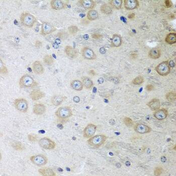 Immunohistochemistry: ATAD3A Antibody [NBP3-38518] - Immunohistochemistry analysis of paraffin-embedded Mouse brain using ATAD3A Rabbit pAb at dilution of 1:100 (40x lens). Microwave antigen retrieval performed with 0.01M PBS Buffer (pH 7.2) prior to IHC staining.
