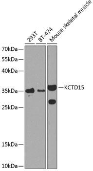 Western Blot: KCTD15 Antibody [NBP3-38520] - Western blot analysis of various lysates using KCTD15 Rabbit pAb at 1:1000 dilution.Secondary antibody: HRP-conjugated Goat anti-Rabbit IgG (H+L) at 1:10000 dilution.Lysates/proteins: 25ug per lane.Blocking buffer: 3% nonfat dry milk in TBST.Detection: ECL Basic Kit.Exposure time: 90s.