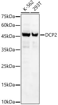 Western Blot: DCP2 Antibody [NBP3-38521] - Western blot analysis of various lysates, using DCP2 Rabbit pAb at 1:1000 dilution.Secondary antibody: HRP-conjugated Goat anti-Rabbit IgG (H+L) at 1:10000 dilution.Lysates/proteins: 25ug per lane.Blocking buffer: 3% nonfat dry milk in TBST.Detection: ECL Basic Kit.Exposure time: 90s.