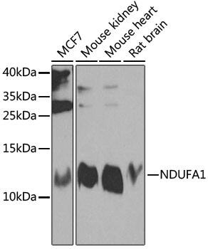 Western Blot: NDUFA1 Antibody [NBP3-38523] - Western blot analysis of various lysates using NDUFA1 Rabbit pAb at 1:1000 dilution.Secondary antibody: HRP-conjugated Goat anti-Rabbit IgG (H+L) at 1:10000 dilution.Lysates/proteins: 25ug per lane.Blocking buffer: 3% nonfat dry milk in TBST.Detection: ECL Enhanced Kit.Exposure time: 30s.