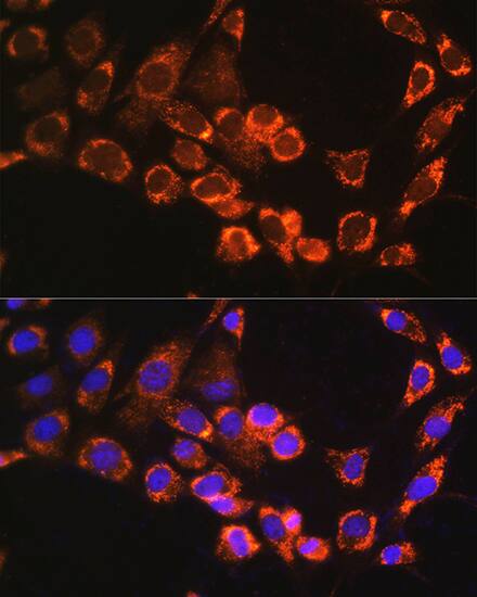 Immunocytochemistry/ Immunofluorescence: TRIM23 Antibody [NBP3-38524] - Immunofluorescence analysis of NIH/3T3 cells using TRIM23 Rabbit pAb at dilution of 1:100. Secondary antibody: Cy3-conjugated Goat anti-Rabbit IgG (H+L) at 1:500 dilution. Blue: DAPI for nuclear staining.