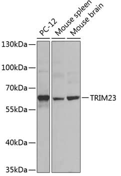 Western Blot: TRIM23 Antibody [NBP3-38524] - Western blot analysis of various lysates using TRIM23 Rabbit pAb at 1:1000 dilution.Secondary antibody: HRP-conjugated Goat anti-Rabbit IgG (H+L) at 1:10000 dilution.Lysates/proteins: 25ug per lane.Blocking buffer: 3% nonfat dry milk in TBST.Detection: ECL Basic Kit.Exposure time: 60s.