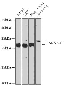 Western Blot: Apc10 Antibody [NBP3-38525] - Western blot analysis of various lysates using Apc10 Rabbit pAb at 1:1000 dilution.Secondary antibody: HRP-conjugated Goat anti-Rabbit IgG (H+L) at 1:10000 dilution.Lysates/proteins: 25ug per lane.Blocking buffer: 3% nonfat dry milk in TBST.Detection: ECL Enhanced Kit.Exposure time: 60s.