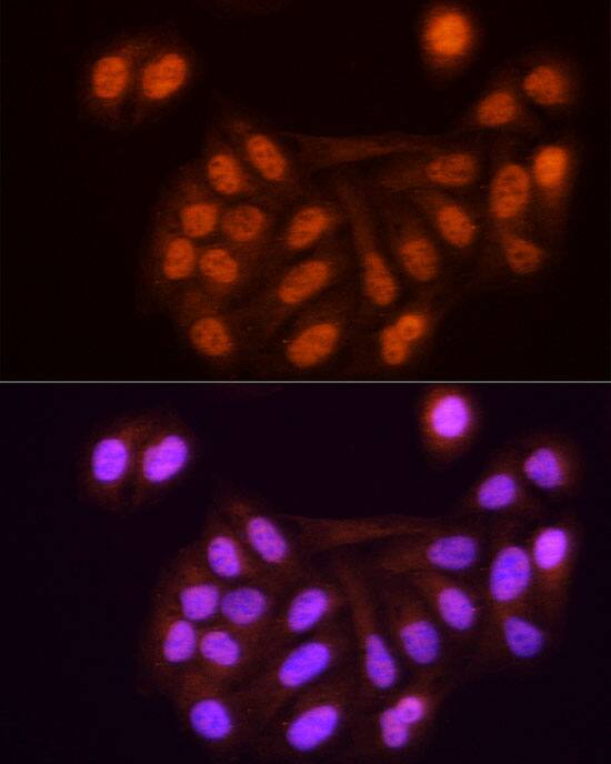 Immunocytochemistry/ Immunofluorescence: KPNA3 Antibody [NBP3-38526] - Immunofluorescence analysis of U2OS cells using KPNA3 Rabbit pAb at dilution of 1:100 (40x lens). Secondary antibody: Cy3-conjugated Goat anti-Rabbit IgG (H+L) at 1:500 dilution. Blue: DAPI for nuclear staining.