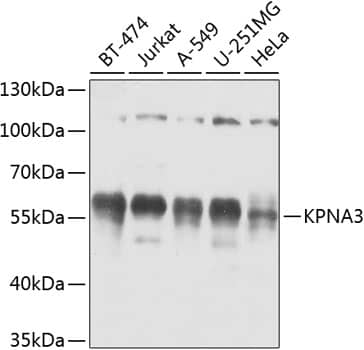 Western Blot: KPNA3 Antibody [NBP3-38526] - Western blot analysis of various lysates using KPNA3 Rabbit pAb at 1:1000 dilution.Secondary antibody: HRP-conjugated Goat anti-Rabbit IgG (H+L) at 1:10000 dilution.Lysates/proteins: 25ug per lane.Blocking buffer: 3% nonfat dry milk in TBST.Detection: ECL Basic Kit.Exposure time: 5s.