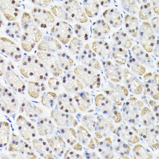 Immunohistochemistry: KPNA3 Antibody [NBP3-38526] - Immunohistochemistry analysis of paraffin-embedded Rat stomach using KPNA3 Rabbit pAb at dilution of 1:100 (40x lens). High pressure antigen retrieval performed with 0.01M Citrate Bufferr (pH 6.0) prior to IHC staining.