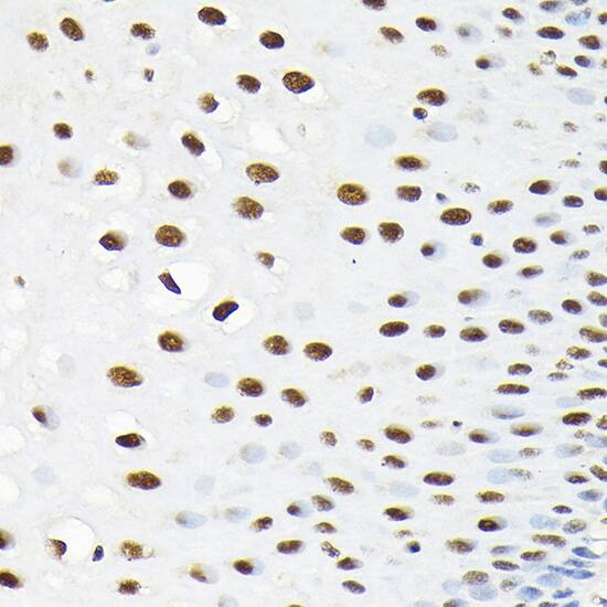 Immunohistochemistry: KPNA3 Antibody [NBP3-38526] - Immunohistochemistry analysis of paraffin-embedded Human esophageal using KPNA3 Rabbit pAb at dilution of 1:100 (40x lens). High pressure antigen retrieval performed with 0.01M Citrate Bufferr (pH 6.0) prior to IHC staining.