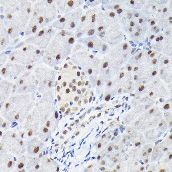 Immunohistochemistry: KPNA3 Antibody [NBP3-38526] - Immunohistochemistry analysis of paraffin-embedded Mouse pancreas using KPNA3 Rabbit pAb at dilution of 1:100 (40x lens). High pressure antigen retrieval performed with 0.01M Citrate Bufferr (pH 6.0) prior to IHC staining.