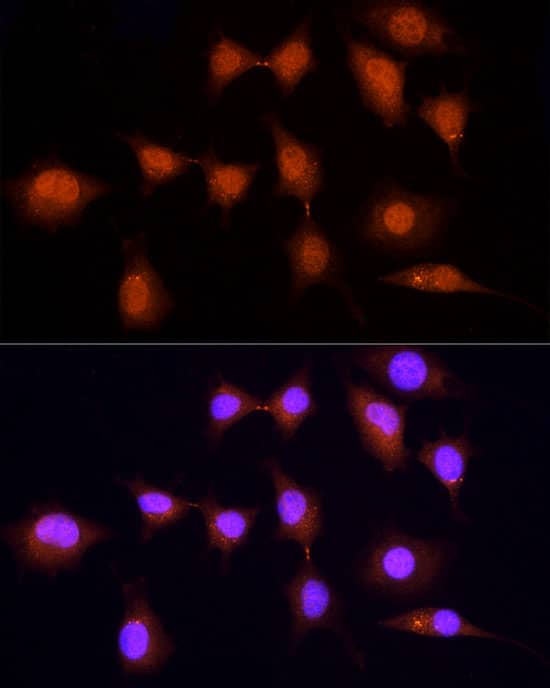 Immunocytochemistry/ Immunofluorescence: KPNA3 Antibody [NBP3-38526] - Immunofluorescence analysis of L929 cells using KPNA3 Rabbit pAb at dilution of 1:100 (40x lens). Secondary antibody: Cy3-conjugated Goat anti-Rabbit IgG (H+L) at 1:500 dilution. Blue: DAPI for nuclear staining.