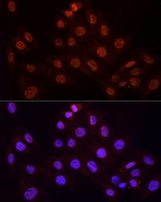 Immunocytochemistry/ Immunofluorescence: KPNA3 Antibody [NBP3-38526] - Immunofluorescence analysis of H9C2 cells using KPNA3 Rabbit pAb at dilution of 1:100 (40x lens). Secondary antibody: Cy3-conjugated Goat anti-Rabbit IgG (H+L) at 1:500 dilution. Blue: DAPI for nuclear staining.