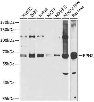 Western Blot: Ribophorin II Antibody [NBP3-38527] - Western blot analysis of various lysates using Ribophorin II Rabbit pAb at 1:1000 dilution.Secondary antibody: HRP-conjugated Goat anti-Rabbit IgG (H+L) at 1:10000 dilution.Lysates/proteins: 25ug per lane.Blocking buffer: 3% nonfat dry milk in TBST.Detection: ECL Basic Kit.Exposure time: 60s.