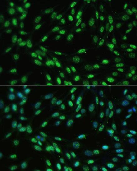 Immunocytochemistry/ Immunofluorescence: UAP56 Antibody [NBP3-38530] - Immunofluorescence analysis of NIH-3T3 cells using UAP56 Rabbit pAb at dilution of 1:100 (40x lens). Secondary antibody: Cy3-conjugated Goat anti-Rabbit IgG (H+L) at 1:500 dilution. Blue: DAPI for nuclear staining.