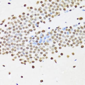 Immunohistochemistry: UAP56 Antibody [NBP3-38530] - Immunohistochemistry analysis of paraffin-embedded Mouse brain using UAP56 Rabbit pAb at dilution of 1:100 (40x lens). Microwave antigen retrieval performed with 0.01M PBS Buffer (pH 7.2) prior to IHC staining.