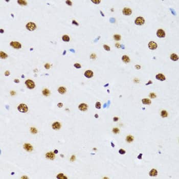 Immunohistochemistry: UAP56 Antibody [NBP3-38530] - Immunohistochemistry analysis of paraffin-embedded Rat brain using UAP56 Rabbit pAb at dilution of 1:100 (40x lens). Microwave antigen retrieval performed with 0.01M PBS Buffer (pH 7.2) prior to IHC staining.