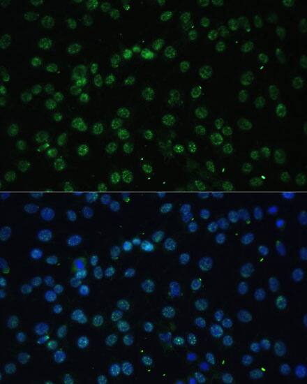 Immunocytochemistry/ Immunofluorescence UAP56 Antibody