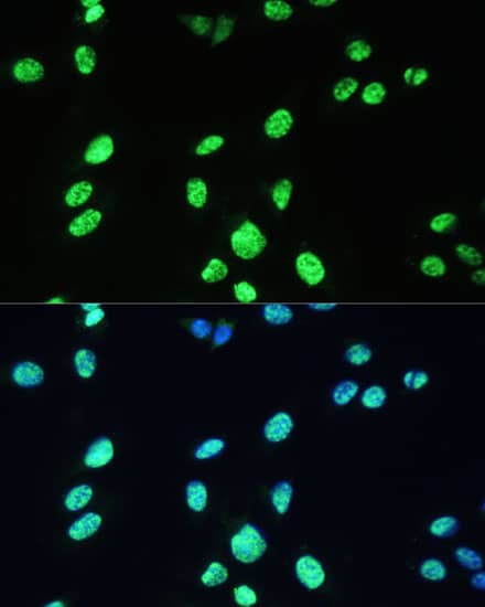 Immunocytochemistry/ Immunofluorescence: UAP56 Antibody [NBP3-38530] - Immunofluorescence analysis of U-2 OS cells using UAP56 Rabbit pAb at dilution of 1:100 (40x lens). Secondary antibody: Cy3-conjugated Goat anti-Rabbit IgG (H+L) at 1:500 dilution. Blue: DAPI for nuclear staining.