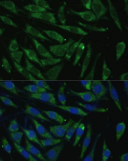 Immunocytochemistry/ Immunofluorescence: PITRM1 Antibody [NBP3-38531] - Immunofluorescence analysis of L929 cells using PITRM1 Rabbit pAb at dilution of 1:100 (40x lens). Secondary antibody: Cy3-conjugated Goat anti-Rabbit IgG (H+L) at 1:500 dilution. Blue: DAPI for nuclear staining.