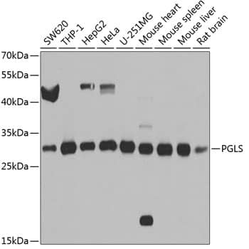 Western Blot: PGLS Antibody [NBP3-38532] - Western blot analysis of various lysates using PGLS Rabbit pAb at 1:1000 dilution.Secondary antibody: HRP-conjugated Goat anti-Rabbit IgG (H+L) at 1:10000 dilution.Lysates/proteins: 25ug per lane.Blocking buffer: 3% nonfat dry milk in TBST.Detection: ECL Basic Kit.Exposure time: 5s.