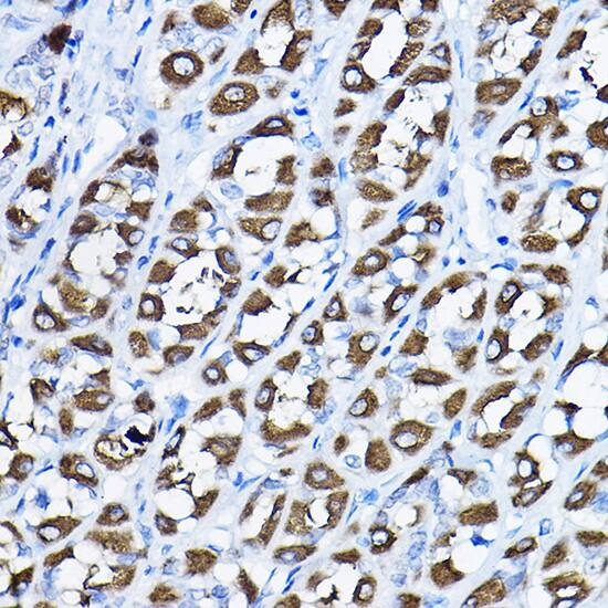 Immunohistochemistry: PGLS Antibody [NBP3-38532] - Immunohistochemistry analysis of paraffin-embedded Rat stomach using PGLS Rabbit pAb at dilution of 1:200 (40x lens). High pressure antigen retrieval performed with 0.01M Citrate Bufferr (pH 6.0) prior to IHC staining.