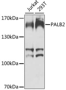 Western Blot: PALB2 Antibody [NBP3-38533] - Western blot analysis of various lysates using PALB2 Rabbit pAb at 1:1000 dilution.Secondary antibody: HRP-conjugated Goat anti-Rabbit IgG (H+L) at 1:10000 dilution.Lysates/proteins: 25ug per lane.Blocking buffer: 3% nonfat dry milk in TBST.Detection: ECL Basic Kit.Exposure time: 60s.