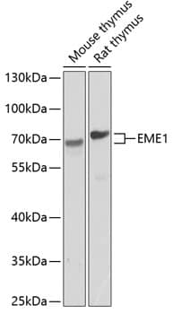 Western Blot: EME1 Antibody [NBP3-38534] - Western blot analysis of various lysates using EME1 Rabbit pAb at 1:1000 dilution.Secondary antibody: HRP-conjugated Goat anti-Rabbit IgG (H+L) at 1:10000 dilution.Lysates/proteins: 25ug per lane.Blocking buffer: 3% nonfat dry milk in TBST.Detection: ECL Basic Kit.Exposure time: 90s.