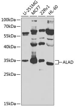 Western Blot: ALAD Antibody [NBP3-38535] - Western blot analysis of various lysates using ALAD Rabbit pAb at 1:1000 dilution.Secondary antibody: HRP-conjugated Goat anti-Rabbit IgG (H+L) at 1:10000 dilution.Lysates/proteins: 25ug per lane.Blocking buffer: 3% nonfat dry milk in TBST.Detection: ECL Basic Kit.Exposure time: 90s.