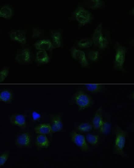 Immunocytochemistry/ Immunofluorescence: CLTB Antibody [NBP3-38536] - Immunofluorescence analysis of HeLa cells using CLTB Rabbit pAb at dilution of 1:100 (40x lens). Secondary antibody: Cy3-conjugated Goat anti-Rabbit IgG (H+L) at 1:500 dilution. Blue: DAPI for nuclear staining.