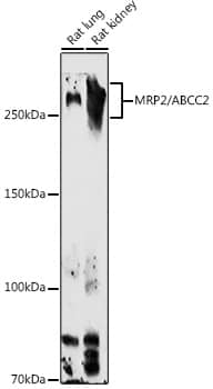 Western Blot: MRP2 Antibody [NBP3-38537] - Western blot analysis of various lysates using MRP2 Rabbit pAb at 1:1000 dilution.Secondary antibody: HRP-conjugated Goat anti-Rabbit IgG (H+L) at 1:10000 dilution.Lysates/proteins: 25ug per lane.Blocking buffer: 3% nonfat dry milk in TBST.Detection: ECL Basic Kit.Exposure time: 90s.