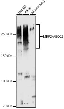 Western Blot: MRP2 Antibody [NBP3-38537] - Western blot analysis of various lysates using MRP2 Rabbit pAb at 1:1000 dilution.Secondary antibody: HRP-conjugated Goat anti-Rabbit IgG (H+L) at 1:10000 dilution.Lysates/proteins: 25ug per lane.Blocking buffer: 3% nonfat dry milk in TBST.Detection: ECL Basic Kit.Exposure time: 30s.